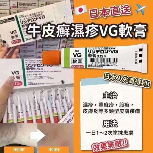 日本牛皮癬濕疹VG軟膏