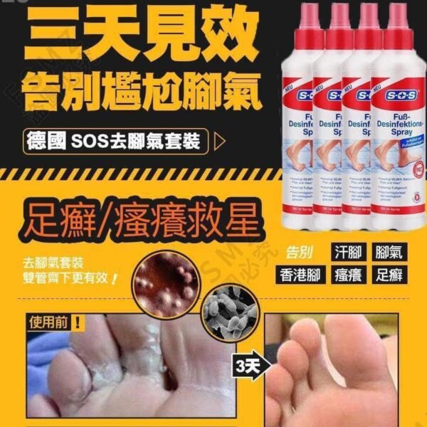 德國SOS足癬/痕癢腳氣水
